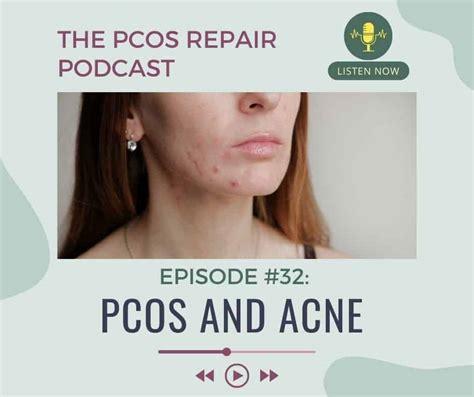 Episode #32: PCOS and Acne - Nourished to Healthy