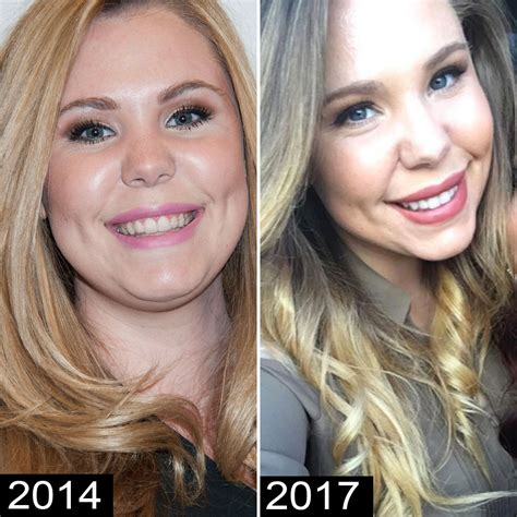 Kailyn Lowry's Plastic Surgery Transformation: Before and After Pics