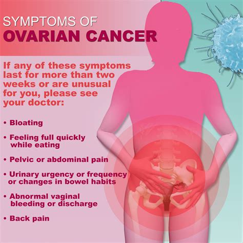 New Ovarian Cancer Screening Twice as Effective - The Gazette Review