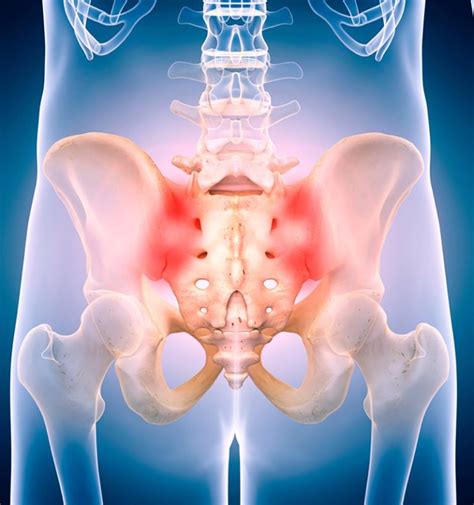 Sacroiliac Joint Injection » Chalfont Pain Management | Delaware Valley Pain & Spine Institute