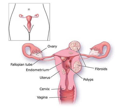 Menorrhagia (Heavy Menstrual Bleeding): Causes, Symptoms, Treatment