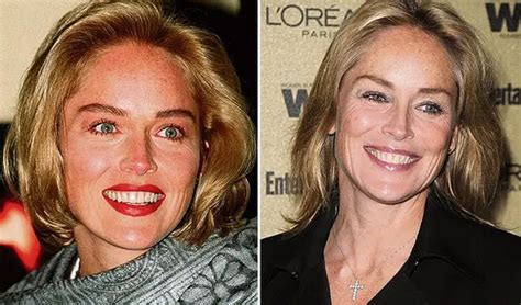 Sharon Stone Facelift Plastic Surgery Before and After | Celebie