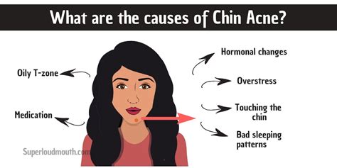 Pimples on Chin meaning: How to get rid of break out on Chin