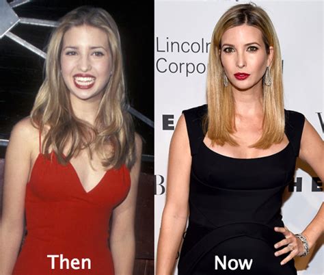 Ivanka Trump Plastic Surgery Before and After - Latest Plastic Surgery ...