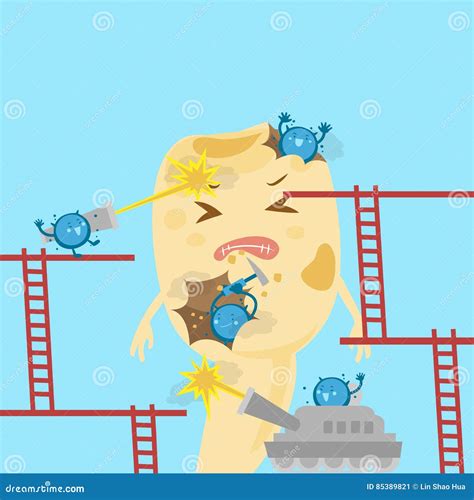 Milk Tooth with Decay Problem Stock Vector - Illustration of cavity, bacterium: 85389821