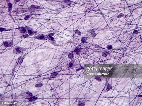 Collagen Fibers Histology Photos and Premium High Res Pictures - Getty Images