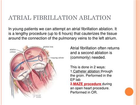 Ablation procedure for atrial fibrillation