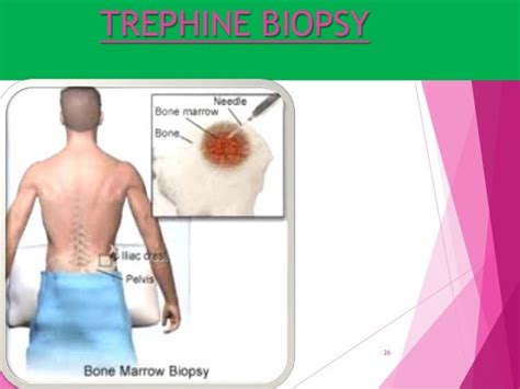 Bone marrow aspiration & trephine biopsy