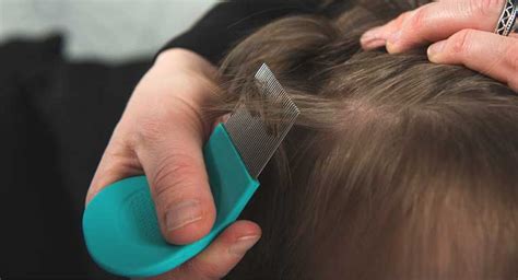 Lice Bites: How to Identify and Treat