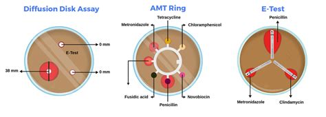 Testing antimicrobial susceptibility - Labster