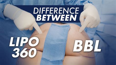 What is the Difference Between LIPO 360 and a BBL? - YouTube