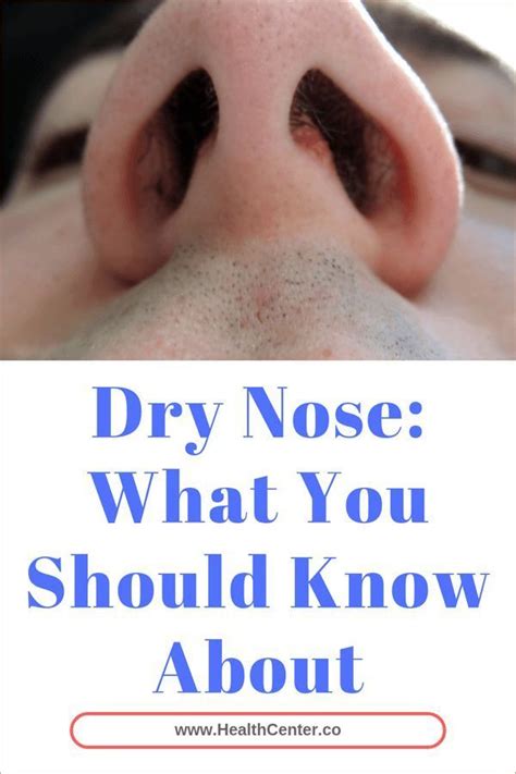 Dry Nose: What You Should Know About | Health Center | Dry nose, Dry ...