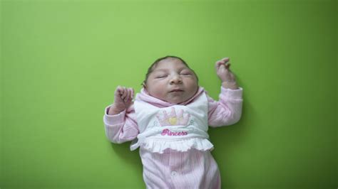 Zika study estimates microcephaly risk for newborns