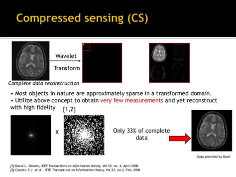 Compressed Sensing MRI — MATLAB Number ONE