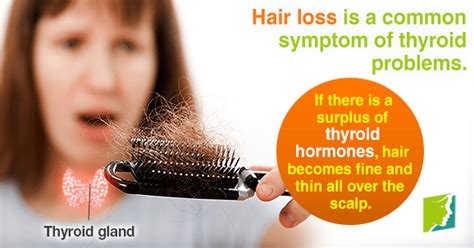 Managing Thyroid Problems and Hair Loss