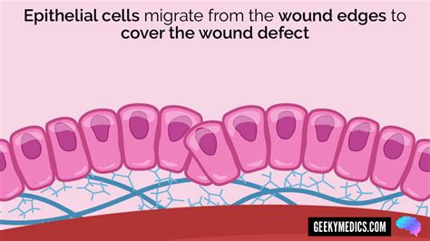 Wound Healing | Stages of Wound Healing | Geeky Medics