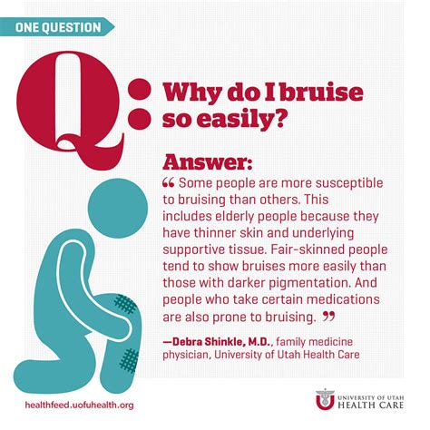 Why Do I Bruise So Easily? | University of Utah Health