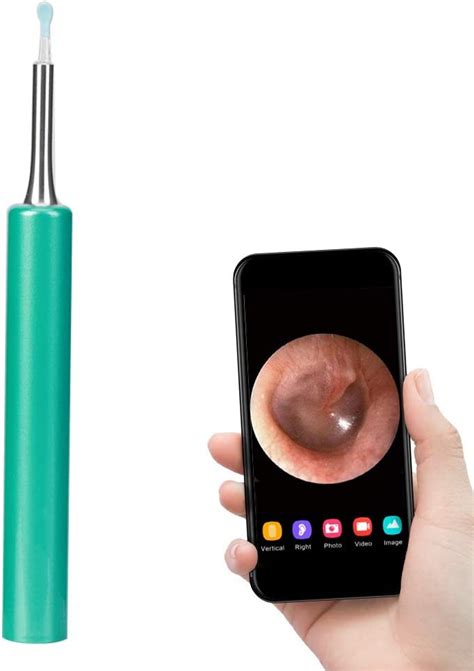 Wireless Endoscope Ear Camera, Ear Inspection Endoscope Camera 1080P HD ...