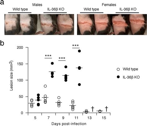 IL-36β deficient mice develop more severe secondary zosteriform skin... | Download Scientific ...