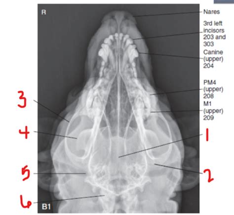 Neurorad 1 (Lecture 10) Flashcards | Quizlet