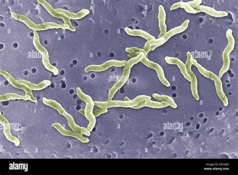 CAMPYLOBACTER JEJUNI Stock Photo - Alamy