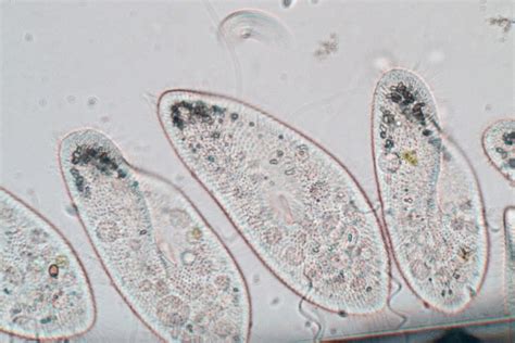 The Largest Single-Celled Organism in the World - IMP WORLD