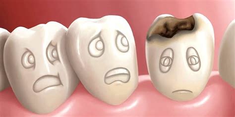 What is the treatment for a tooth decay? Extraction or Restoration ...