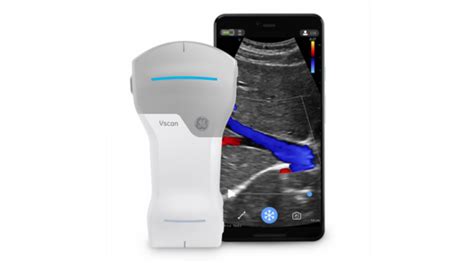 GE Healthcare Unveils Vscan Air, a New Intuitive, Wireless Handheld Ultrasound - G-MedTech News ...