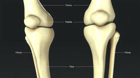 does leg get shorter after femur fracture pictures