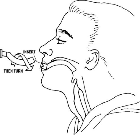 Diagram Of The Airway