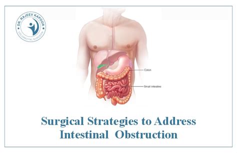 Surgical Strategies To Address Intestinal Obstruction - Surgical Expert ...