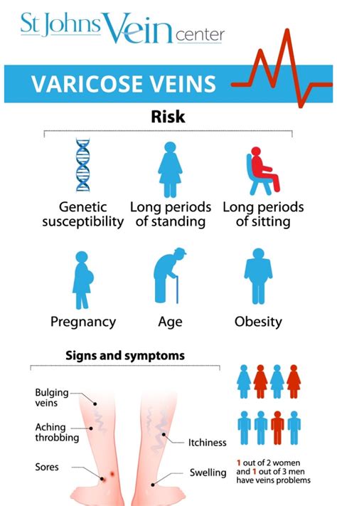 Varicose Veins 101 - A Guide to Varicose Vein Symptoms and Treatment - St Johns Vein Center