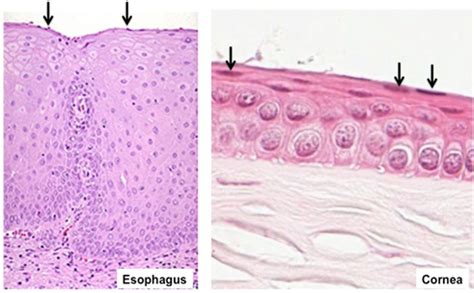 Stratified Squamous Epithelium Tissue