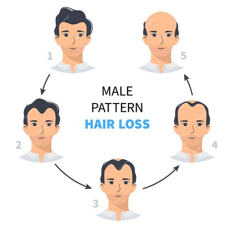 Premium Vector | Hair loss stages androgenetic alopecia male pattern