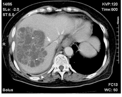 What Is A Ct Scan With Contrast Called