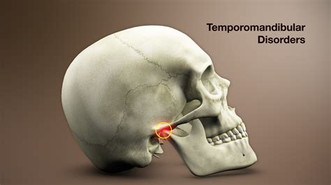 Temporomandibular joint Disorder – Symptoms, Causes, & Treatment