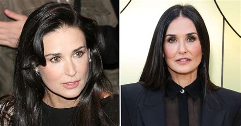 Did Demi Moore Have Plastic Surgery? Doctors Weigh In On Her Look