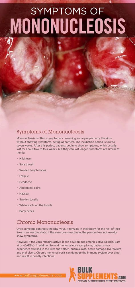 Mononucleosis: Transmission, Symptoms & Treatment