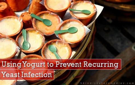 Yogurt for Yeast Infection | Skin Disease Remedies