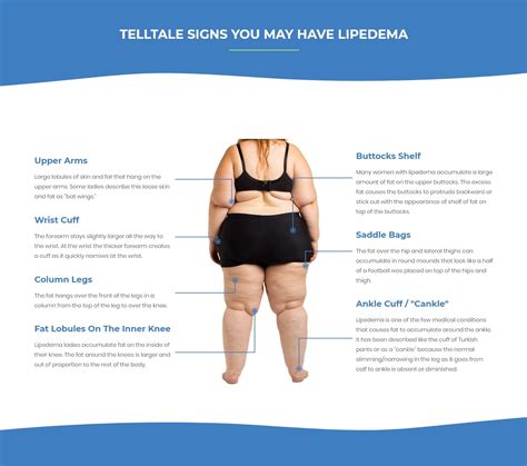 » Battling Your Lipedema Insurance Coverage? You’re Not Alone. - Lipedema