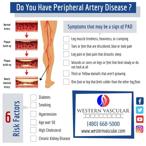 Peripheral Vascular Disease Treatment in Phoenix, Arizona