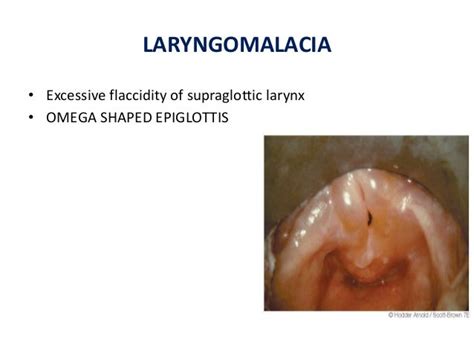 Larynx