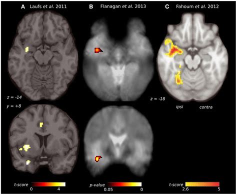 Piriform Cortex Anatomy