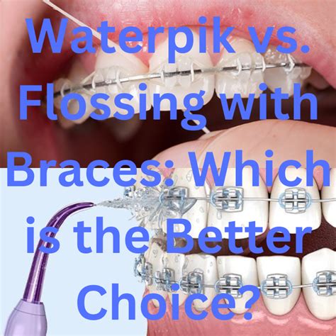 Waterpik vs. Flossing with Braces: Which is the Better Choice? | by HOC Publishing | May, 2024 ...