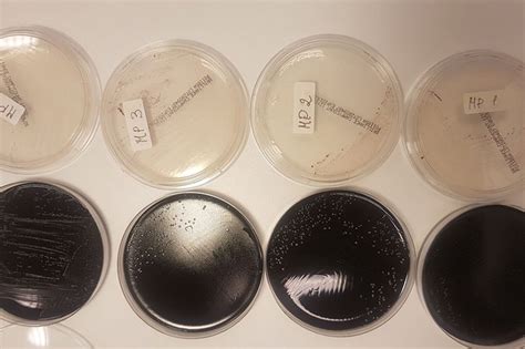 New and fast detection of Campylobacter - Poultry World