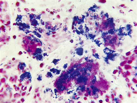 Gram Positive & Gram Negative Bacteria Histology Slides, Animal