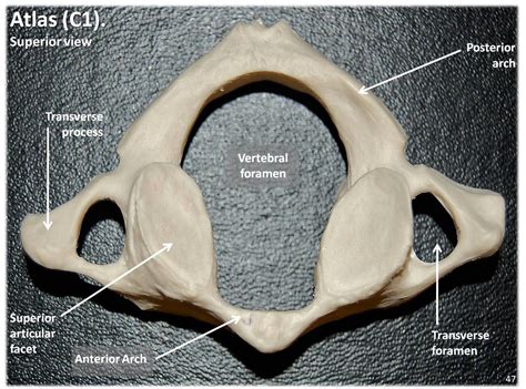 Atlas C1 vertebra, superior view with labels - Axial Skele… | Flickr