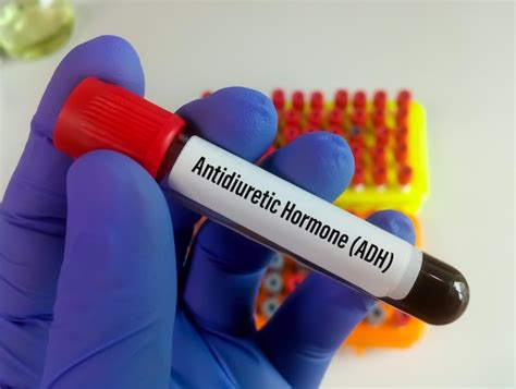 Premium Photo | Scientist hold blood sample for adh or antidiuretic hormone or vasopressin test