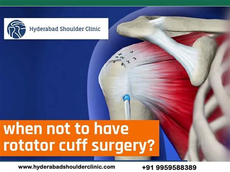 partial rotator cuff tear treatment in Hyderabad - shoulder clinic ...