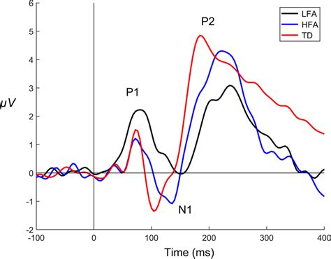 Visual evoked potential waveforms recorded from electrode Oz and... | Download Scientific Diagram